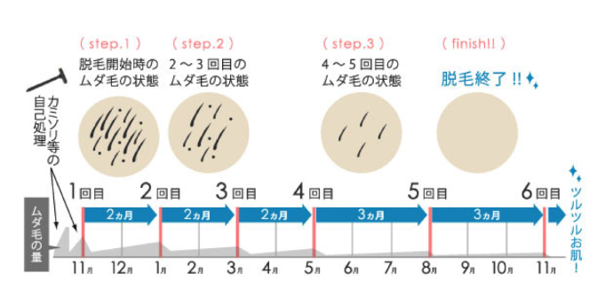 脱毛スケジュール