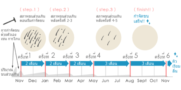 ตารางเวลาการกำจัดขน